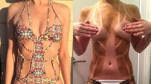 You meticulously applied sunscreen, but you still wound up with comical tan lines. 23 Funny Or Painful Looking Pics Of Bad Tan Lines