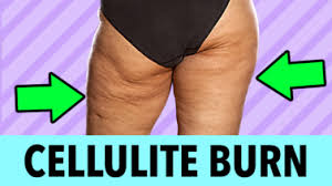 It is by far the easiest way to get rid of that unsightly dimples. Cellulite Burn Roberta S Gym At Home Fitness Workouts And Exercises