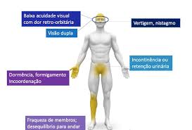 Na sua maioria estes são portadores de esclerose múltipla e doentes do foro neurológico. Esclerose Multipla Em