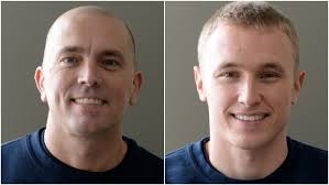 15 to become St. Paul firefighters. They're badly needed amid recruiting  challenges.