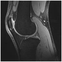 Knee muscle anatomy mri : Getting Ready For An Mri Of Your Knee Sansum Clinic