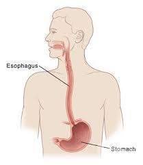 Esophageal cancer - India Against Cancer