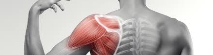 Image result for Shoulder Subluxation