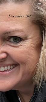 Rowe Casa Organics products for skin improvement and anti-aging