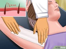 An ingrown hair can also occur in straight hairs areas where there are skin folds or scars, which may increase the likelihood of the hairs penetrating the skin. 3 Ways To Prevent Ingrown Hairs On The Pubic Area Wikihow
