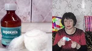 как вылечить грибок ногтя на ноге в домашних условиях Kak Realno Vylechit Gribok Nogtej Na Nogah Narodnymi Sredstvami Moj Opyt Nogti Na Nogah Tovary Dlya Zdorovya Alternativnaya Medicina