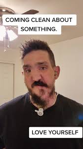 Edwin Castillo Physical Therapist