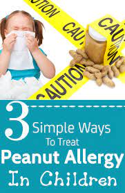 Food Allergies In Children Symptoms Foods To Avoid And Safety Measures Kids Allergies Allergies Peanut Allergy