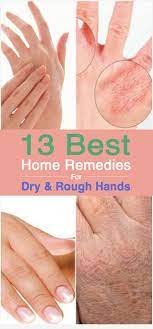 13 Best Home Remedies For Dry And Rough Hands Rough Hands Dry Skin Remedies Skin Remedies