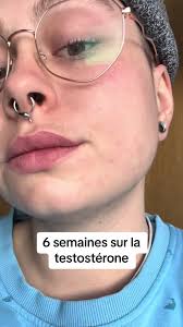 Camille Moustachemolle