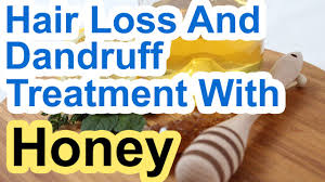 It provides vital proteins to hair to survive damages. Hair Loss And Dandruff Treatment With Honey Youtube