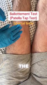 Image result for Patella Tracking Assessment