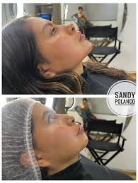 Perfilamiento mandibular, aumento de mentón y Rinomodelación con Ácido  Hialuronico ✨ 💉 Por algo es un trend hoy en día, 🫶🏼 notamos como se  estiliza el perfil de la paciente! Me encanta