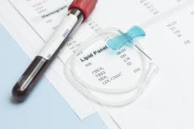 When to see a doctor. Farewell To The Fasting Cholesterol Test Harvard Health