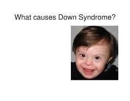 Nce Practice Question Nceprep Factors Cause Down Syndrome Which Produces Mental Retardation Mental Retardation Down Syndrome This Or That Questions