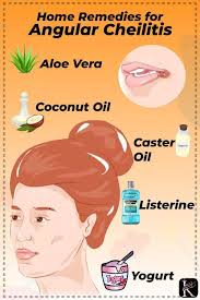 Symptoms Of Angular Cheilitis Will Almost Appear At The Edges Of The Mouth Learn More About Cracks Corne Cracked Corners Of Mouth Pimple In Mouth Skin Dryness