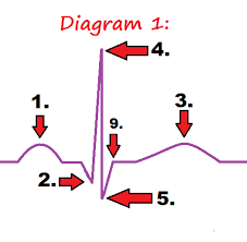 Ekg Pqrst Rhythm Strip Wave Quiz Anatomy Pathophysiology