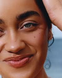 Image result for Freckles