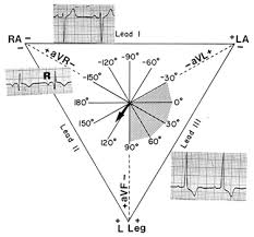 Ecg Learning Center An Introduction To Clinical