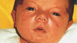 Leah Aldridge: Police find body parts of baby killed in 2002