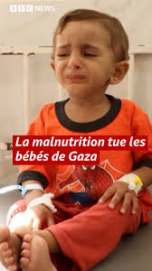 Selon le Dr Mohammed Abu Salmiya, directeur de l'hôpital Shifa à Gaza, 21  enfants sont morts de malnutrition et de famine en trois jours dans toute  la bande de Gaza. , À l'hôpital Rantisi, également ...