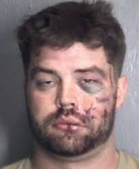 Burglar gets beaten by NC homeowner after breaking into house