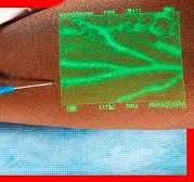 💉 Este Dispositivo Proyecta tus propias VENAS sobre tu PIEL en 3D y en  tiempo real (VeinViewer)
