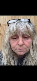 What can be done when a doctor dismisses peripheral neuropathy symptoms as  being in the patient's mind?