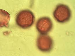 Image result for Erythrococca atrovirens