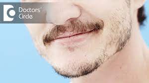 According to the mayo clinic, while there's not a simple yes or no answer, some hair loss. Ways To Fill Patchy Gaps In Beard On Face Dr Sachith Abraham Youtube