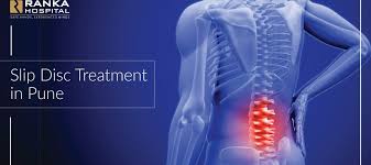 In this post, let us take a look at the symptoms, causes, treatments, and. Slip Disc Treatment In Pune Slipped Disc Treatment Ranka Hospital