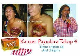 Rawatan bagi pesakit kanser payudara. Tesrimoni Kanser Health And Beauty By Sne Lasoul Facebook