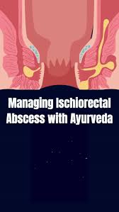 Image result for Ischiorectal Abscess