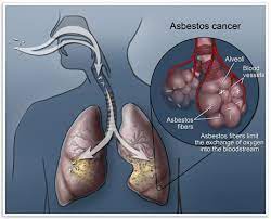 Asbestos Exposure Infographic Who S The Most At Risk