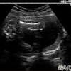 Perkembangan bayi 9 bulan pada otot kakinya akan semakin kuat dan keseimbangannya akan jauh lebih baik bila ia berjalan tanpa alas kaki, bun. Https Encrypted Tbn0 Gstatic Com Images Q Tbn And9gcqtnwbgdxbyes9k9kdfeaww4akgbakgu4fcntex2e Djby2g4qj Usqp Cau