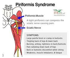 Sciatica is uncommon during pregnancy and may be the symptom of an underlying medical condition. Sciatica Stretches Pregnancy