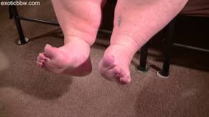 bbwglamour on X: @bbwglamour this is the next clip. like it or not, ssbbw  feet and cankles http:t.co1ZcDLezVSM  X