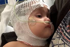 Fundraiser by EJ Irene Martinez : Gianna's cyst surgery and recovery