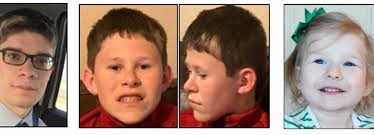 Pitt-Hopkins Syndrome: A Review of Current Literature, Clinical Approach,  and 23-Patient Case Series