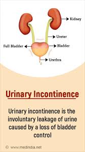 Image result for Urinary Incontinence