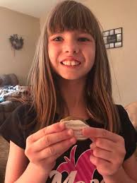 Found this beauty at the vets park