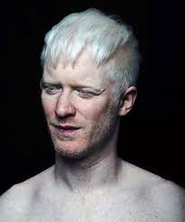 Albino Man | nude | NAKED BRITAIN | ANASTASIA TRAHANAS
