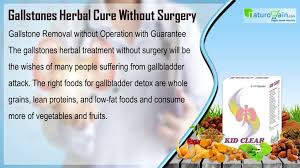 See more ideas about gallbladder stones, surgery operation, gallbladder. Ppt Gallbladder Detox Foods Herbal Treatment For Gallstones Without Surgery Powerpoint Presentation Id 8014540