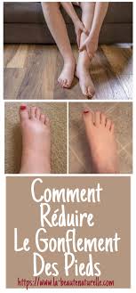 Voici un remède naturel contre les pieds gonflés. Douleurs Aux Pieds Chevilles Jambes Genoux Hanches Et Bas Du Dos Genou Gonfle Des Causes Diverses