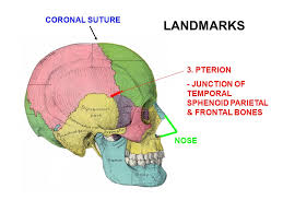 The frontal bone was doubled because of complete metopic suture. I Calvarium Skull Cap Consists Of Bones Linked By Sutures Ppt Video Online Download