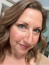 How to get a skin cancer screening in Nelson, B.C. without a family doctor?