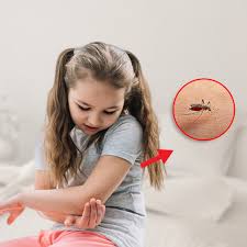 Image result for mosquito bite