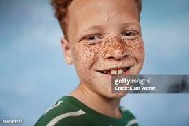 Image result for Freckles