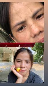 Yog mej leej twg lub tse muag muaj2 npob muaj hiav muaj nquav hnav peb  nqias nej los xiv xuv tshuaj no nawb siv lawm zoo heev li o thiab nw pab