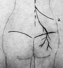 Maybe you would like to learn more about one of these? Back Pain Go Away